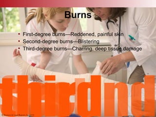 © Business & Legal Reports, Inc. 1110
Burns
• First-degree burns—Reddened, painful skin
• Second-degree burns—Blistering
• Third-degree burns—Charring, deep tissue damage
© Business & Legal Reports, Inc. 1110
 