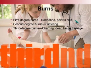 © Business & Legal Reports, Inc. 1110
Burns
• First-degree burns—Reddened, painful skin
• Second-degree burns—Blistering
•...