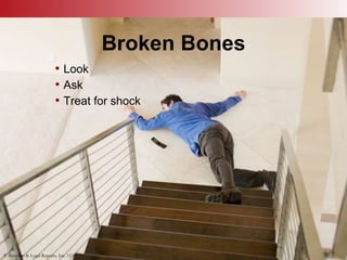 © Business & Legal Reports, Inc. 1110
Broken Bones
• Look
• Ask
• Treat for shock
© Business & Legal Reports, Inc. 1110
 