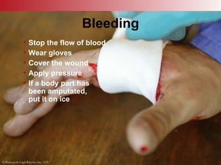 © Business & Legal Reports, Inc. 1110
Bleeding
• Stop the flow of blood
• Wear gloves
• Cover the wound
• Apply pressure
• If a body part has
been amputated,
put it on ice
© Business & Legal Reports, Inc. 1110
 