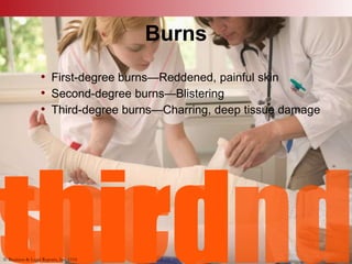 © Business & Legal Reports, Inc. 1110
Burns
• First-degree burns—Reddened, painful skin
• Second-degree burns—Blistering
• Third-degree burns—Charring, deep tissue damage
© Business & Legal Reports, Inc. 1110
 