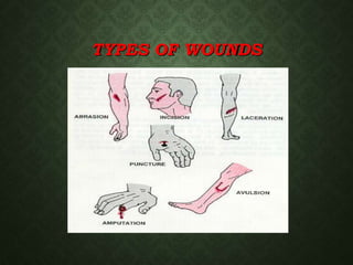 Types Of Cut Injuries Basic_First_Aid_0808.ppt an instructional materials for grade 8 | PPT