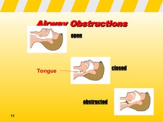 First Air Principles Basic FIRST AID PRINCIPLES AND APPROPRIATE MEASURES | PPT