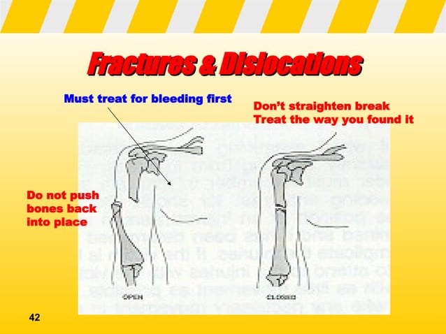 Basic FIRST AID PRINCIPLES AND APPROPRIATE MEASURES | PPT