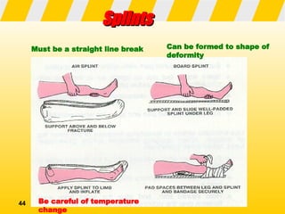 Splint Line Guide Basic First aid Skills and Training PPTX | PPT