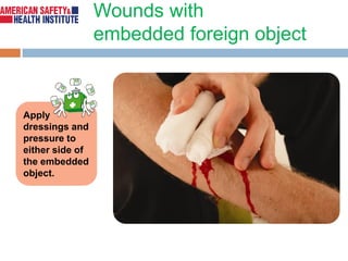 BASIC FIRST AID (BFA).pdf