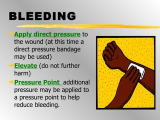BLEEDING Apply direct pressure   to the wound   (at this time a direct pressure bandage may be used) Elevate   (do not further harm) Pressure Point  additional pressure may be applied to a pressure point to help reduce bleeding. 