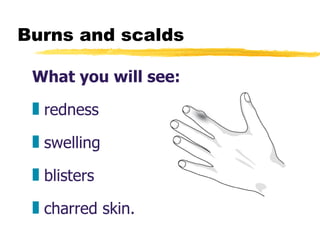 Burns and scalds What you will see: redness swelling blisters charred skin. 