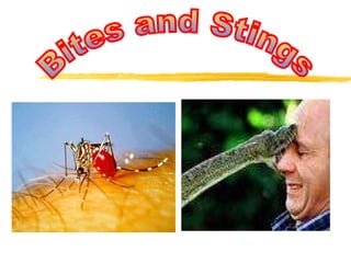 Bites and Stings 