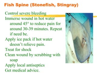 Fish Spine (Stonefish, Stingray) Control severe bleeding Immerse wound in hot water around 45° to reduce pain for around 30-39 minutes. Repeat if need be. Apply ice pack if hot water doesn’t relieve pain. Treat for shock Clean wound by scrubbing with soap Apply local antiseptics Get medical advice. 