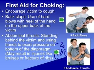 First Aid for Choking:
• Encourage victim to cough
• Back slaps: Use of hard
blows with heel of the hand
on the upper back of the
victim
• Abdominal thrusts: Standing
behind the victim and using
hands to exert pressure on
bottom of the diaphragm
(May result in injuries like
bruises or fracture of ribs)
5 Back Blows
5 Abdominal Thrusts
 