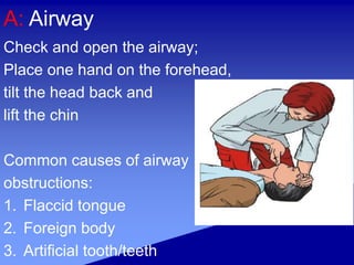 A: Airway
Check and open the airway;
Place one hand on the forehead,
tilt the head back and
lift the chin
Common causes of airway
obstructions:
1. Flaccid tongue
2. Foreign body
3. Artificial tooth/teeth
 