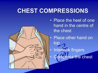 • Place the heel of one
hand in the centre of
the chest
• Place other hand on
top
• Interlock fingers
• Compress the chest
CHEST COMPRESSIONS
 