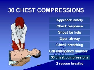 30 CHEST COMPRESSIONS
Approach safely
Check response
Shout for help
Open airway
Check breathing
Call emergency number
30 chest compressions
2 rescue breaths
 