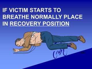 IF VICTIM STARTS TO
BREATHE NORMALLY PLACE
IN RECOVERY POSITION
 