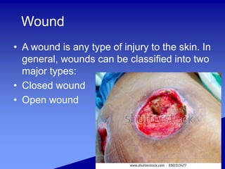Wound
• A wound is any type of injury to the skin. In
general, wounds can be classified into two
major types:
• Closed wound
• Open wound
 