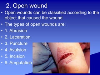 2. Open wound
• Open wounds can be classified according to the
object that caused the wound.
• The types of open wounds are:
• 1. Abrasion
• 2. Laceration
• 3. Puncture
• 4. Avulsion
• 5. Incision
• 6. Amputation
 
