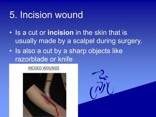 5. Incision wound
• Is a cut or incision in the skin that is
usually made by a scalpel during surgery.
• Is also a cut by a sharp objects like
razorblade or knife
 