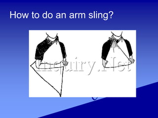 How to do an arm sling?
 