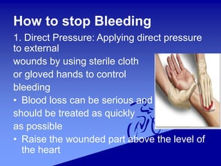 How to stop Bleeding
1. Direct Pressure: Applying direct pressure
to external
wounds by using sterile cloth
or gloved hands to control
bleeding
• Blood loss can be serious and
should be treated as quickly
as possible
• Raise the wounded part above the level of
the heart
 