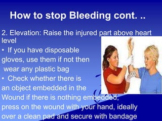 How to stop Bleeding cont. ..
2. Elevation: Raise the injured part above heart
level
• If you have disposable
gloves, use them if not then
wear any plastic bag
• Check whether there is
an object embedded in the
Wound if there is nothing embedded,
press on the wound with your hand, ideally
over a clean pad and secure with bandage
 