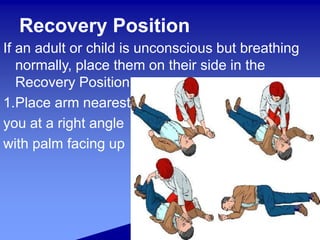 Recovery Position
If an adult or child is unconscious but breathing
normally, place them on their side in the
Recovery Position.
1.Place arm nearest
you at a right angle
with palm facing up
 