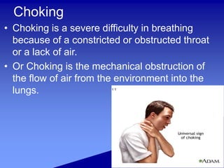 Choking
• Choking is a severe difficulty in breathing
because of a constricted or obstructed throat
or a lack of air.
• Or Choking is the mechanical obstruction of
the flow of air from the environment into the
lungs.
 