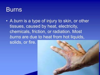 Friction Burn Def Basic first aid for beginners | PPTX