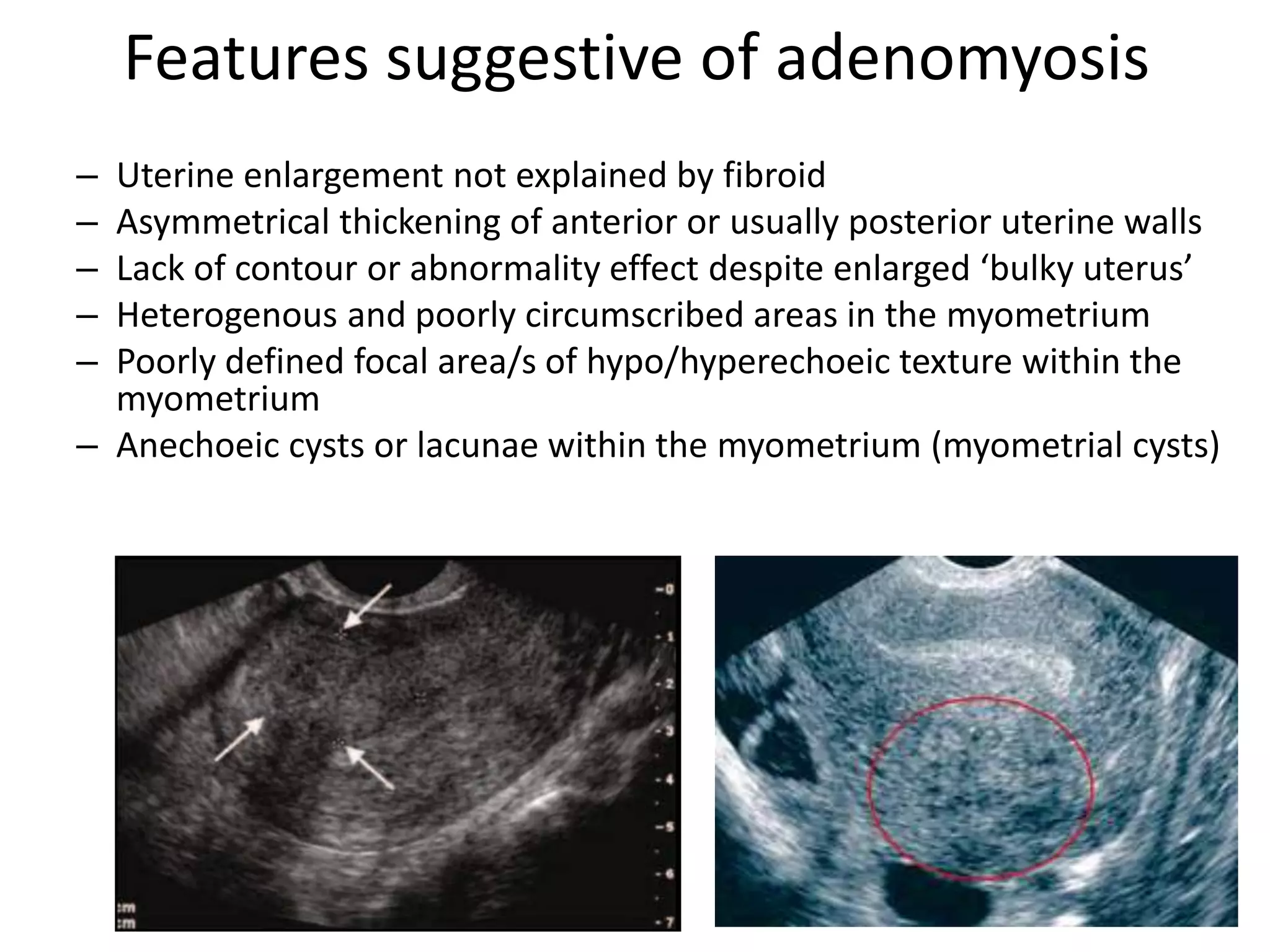 Basic gynae ultrasound | PPTX
