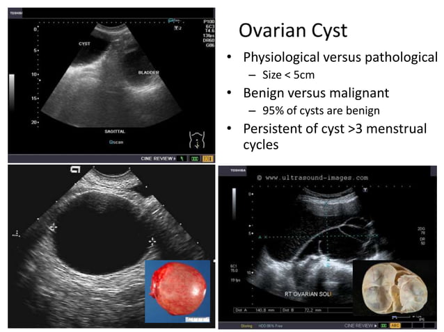 Basic gynae ultrasound | PPTX