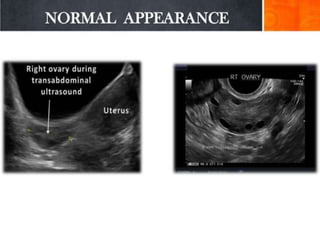 Basic gynae ultrasound