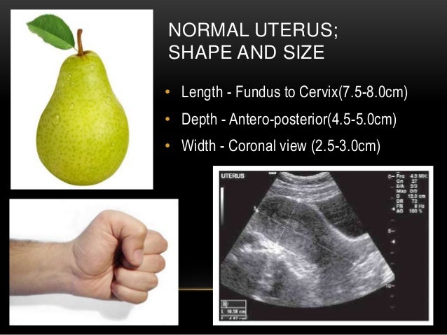 Basic Gynae Ultrasound Basic Gynae Ultrasound