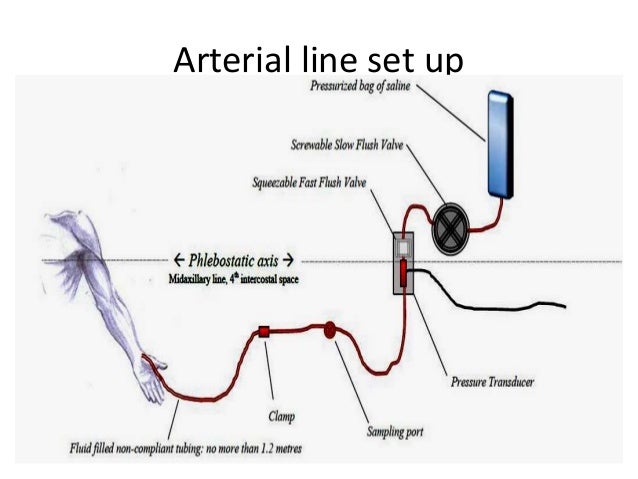 basic haemodynamic monitoring arterial line