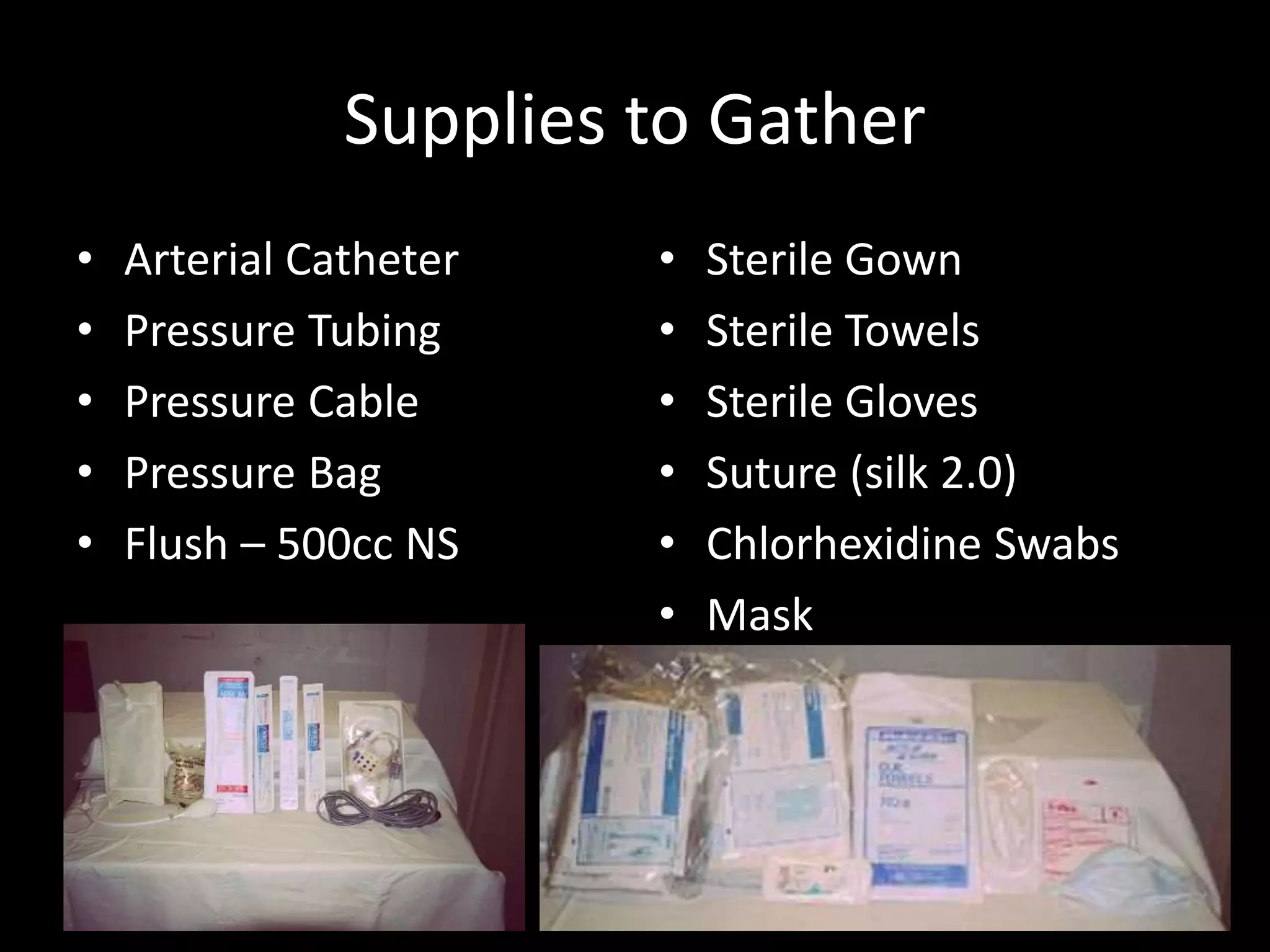 Supplies to Gather
• Arterial Catheter
• Pressure Tubing
• Pressure Cable
• Pressure Bag
• Flush – 500cc NS
• Sterile Gown
• Sterile Towels
• Sterile Gloves
• Suture (silk 2.0)
• Chlorhexidine Swabs
• Mask
 