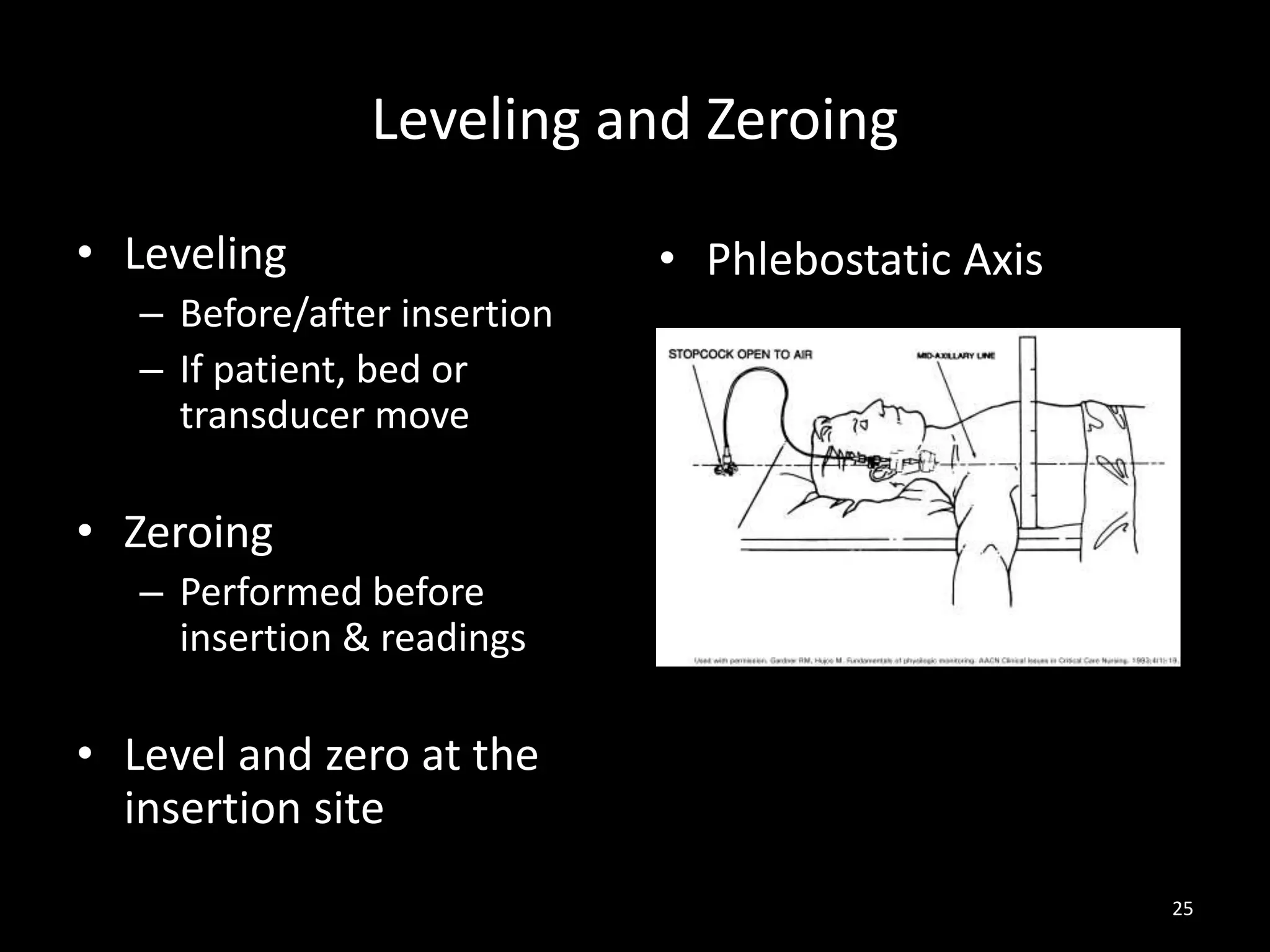 Leveling and Zeroing
• Leveling
– Before/after insertion
– If patient, bed or
transducer move
• Zeroing
– Performed before
insertion & readings
• Level and zero at the
insertion site
25
• Phlebostatic Axis
 