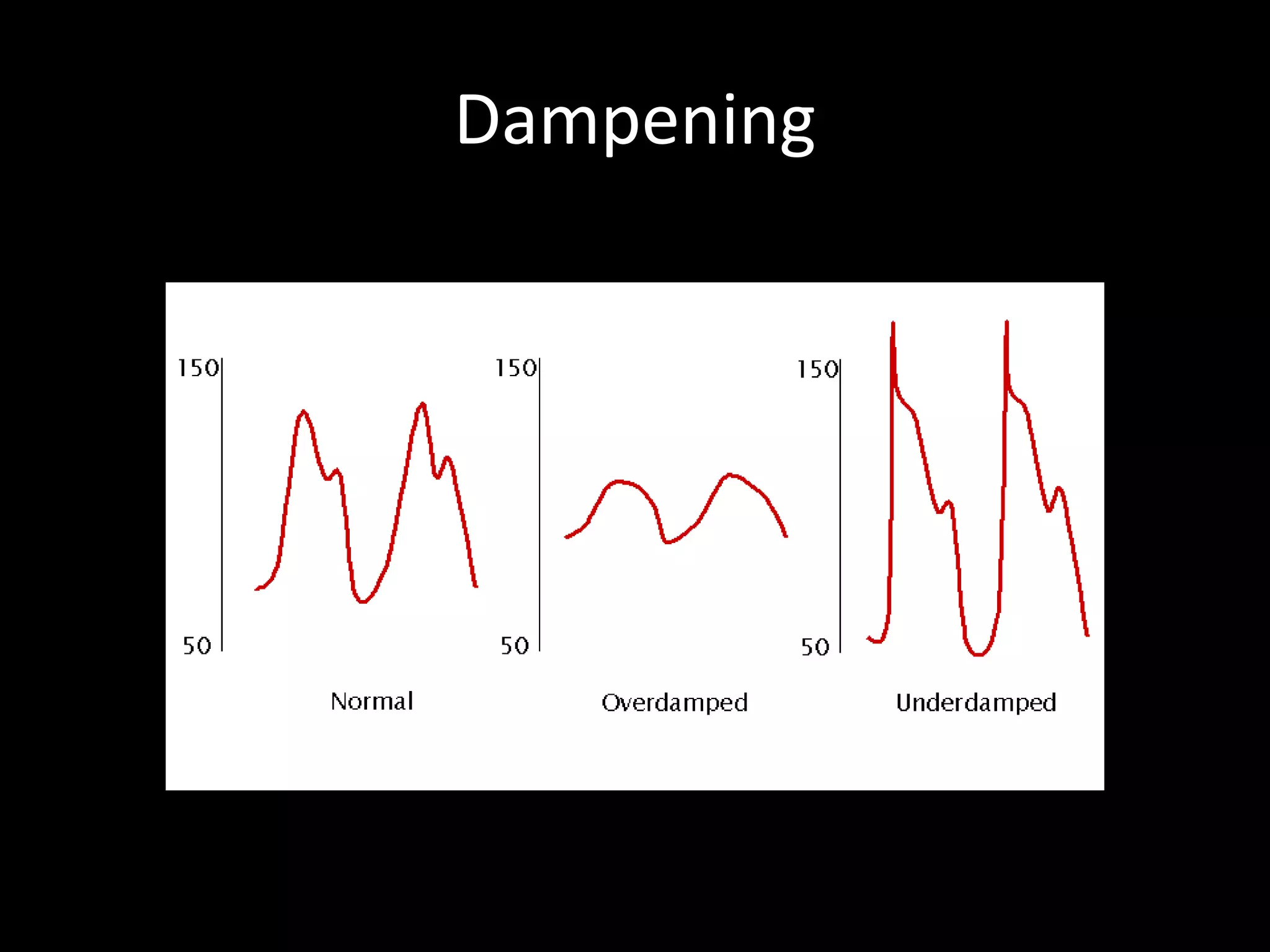 Dampening
 
