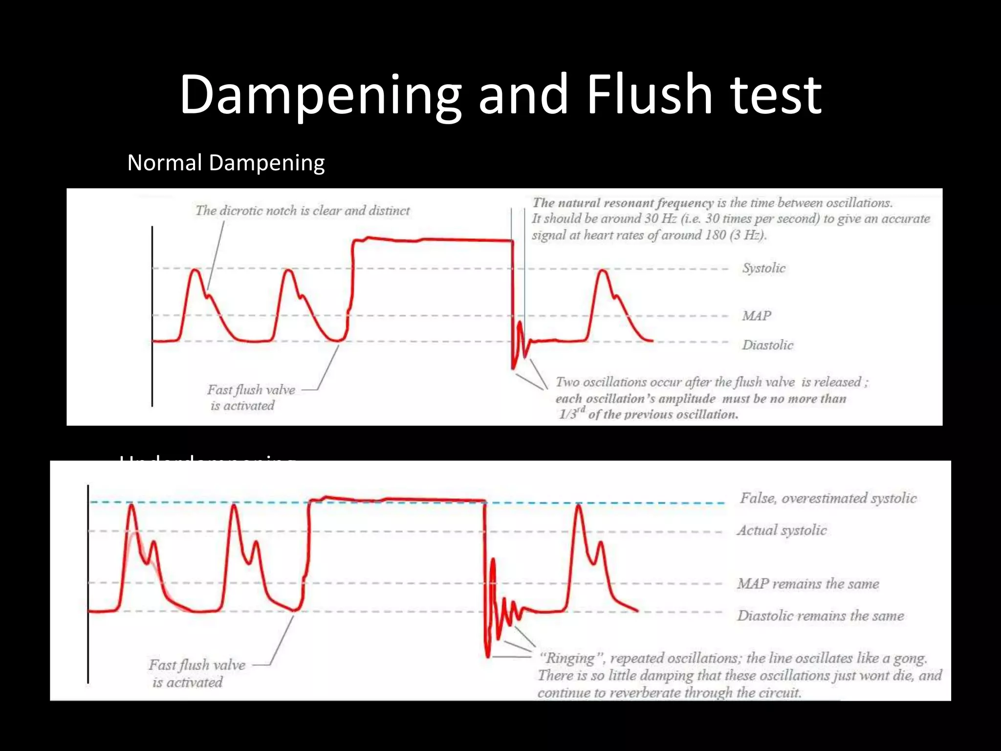 Dampening and Flush test
Underdampening
Normal Dampening
 