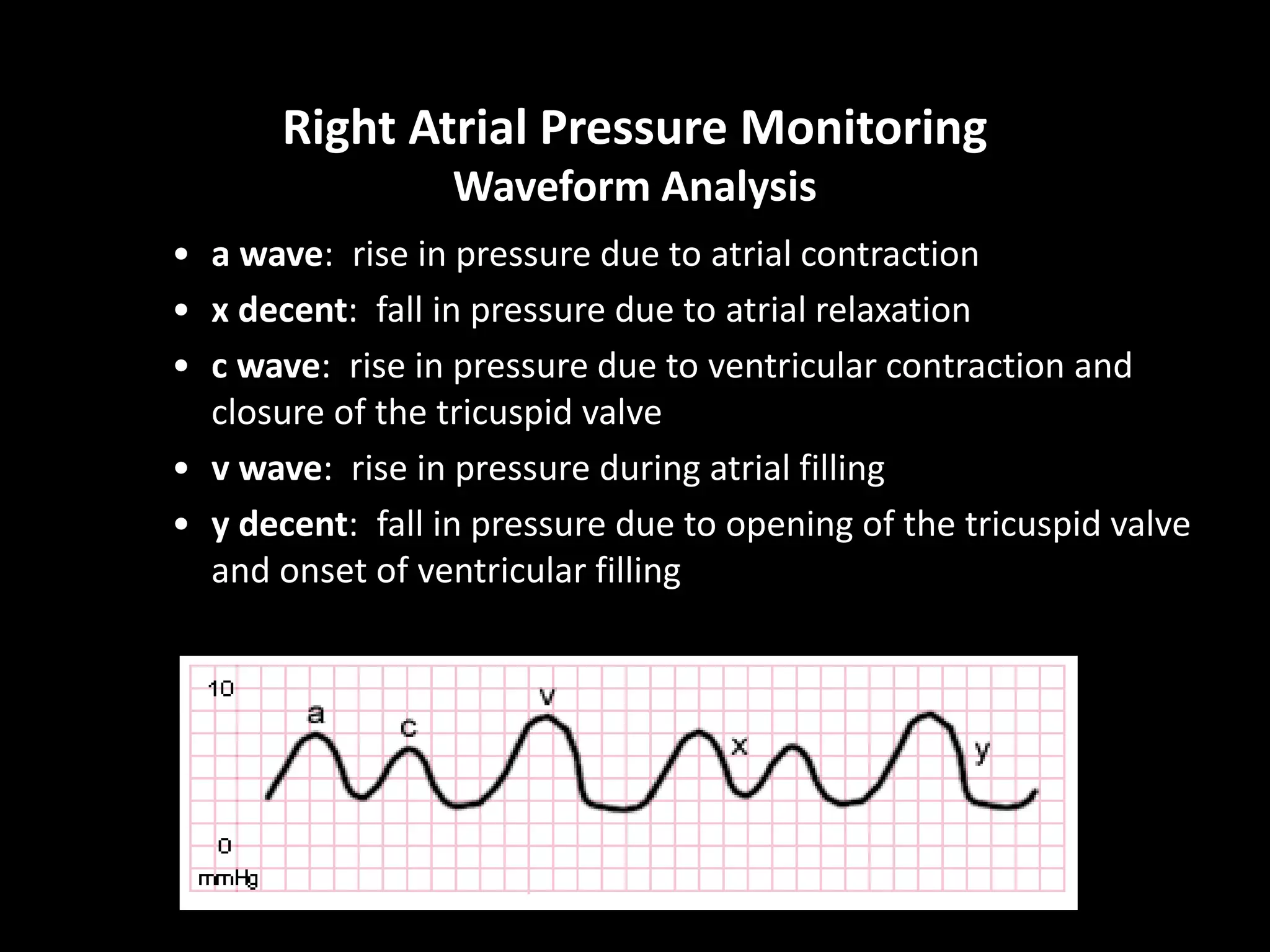 Right Atrial Pressure Monitoring
Waveform Analysis
• a wave: rise in pressure due to atrial contraction
• x decent: fall in pressure due to atrial relaxation
• c wave: rise in pressure due to ventricular contraction and
closure of the tricuspid valve
• v wave: rise in pressure during atrial filling
• y decent: fall in pressure due to opening of the tricuspid valve
and onset of ventricular filling
 