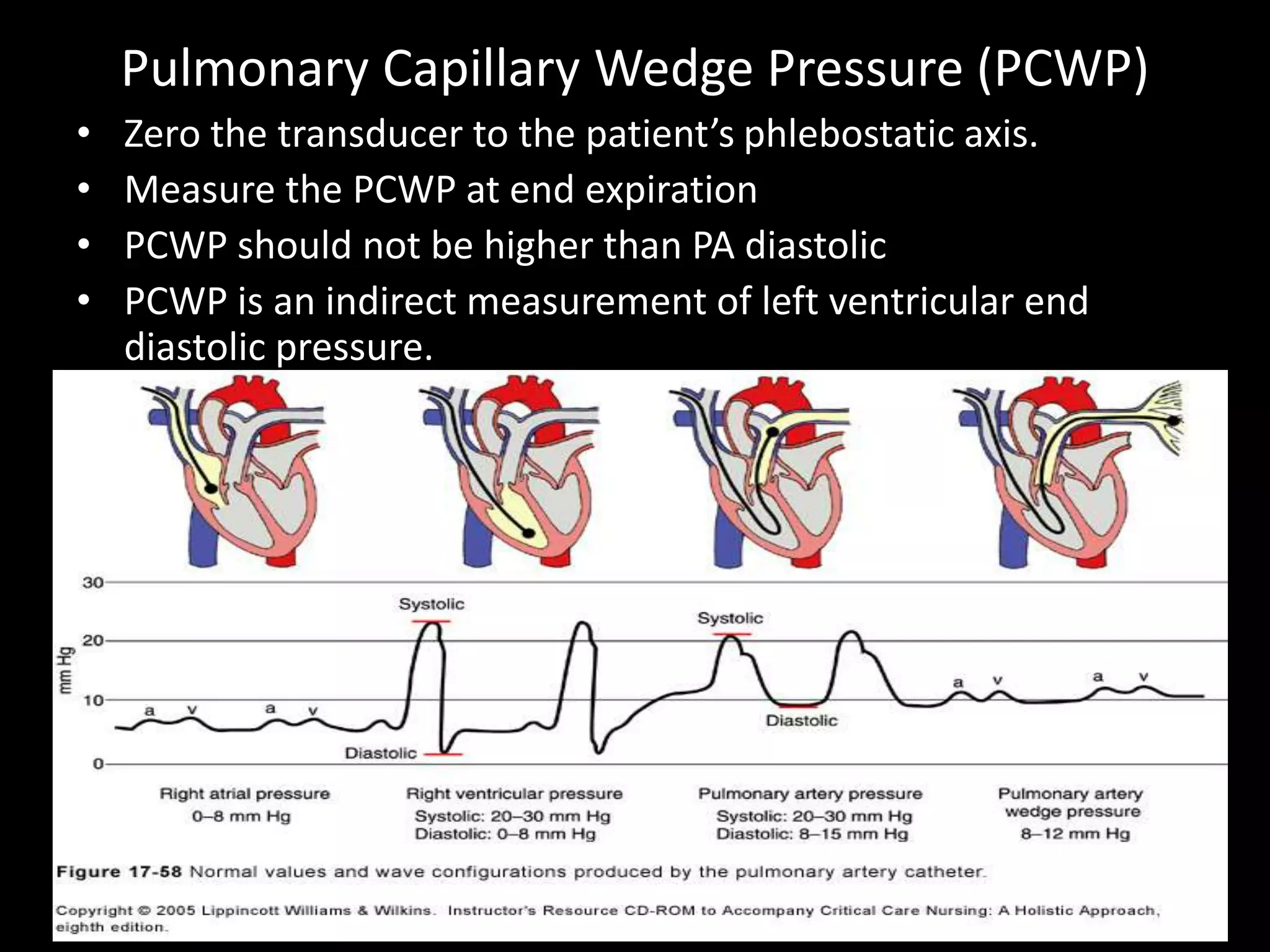 Pulmonary Capillary Wedge Pressure (PCWP)
• Zero the transducer to the patient’s phlebostatic axis.
• Measure the PCWP at end expiration
• PCWP should not be higher than PA diastolic
• PCWP is an indirect measurement of left ventricular end
diastolic pressure.
 