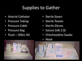 Supplies to Gather
• Arterial Catheter
• Pressure Tubing
• Pressure Cable
• Pressure Bag
• Flush – 500cc NS
• Sterile Gown
• Sterile Towels
• Sterile Gloves
• Suture (silk 2.0)
• Chlorhexidine Swabs
• Mask
 