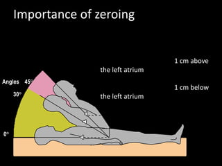 •Re-level the transducer with any
change in the patient’s position
•Referencing the system 1 cm above
the left atrium decreases the
pressure by 0.73 mm Hg
•Referencing the system 1 cm below
the left atrium increases  the
pressure by 0.73 mm Hg
Angles 45°
30°
0°
Importance of zeroing
 