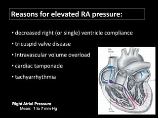 Reasons for elevated RA pressure:
• decreased right (or single) ventricle compliance
• tricuspid valve disease
• Intravascular volume overload
• cardiac tamponade
• tachyarrhythmia
Right Atrial Pressure
Mean: 1 to 7 mm Hg
 