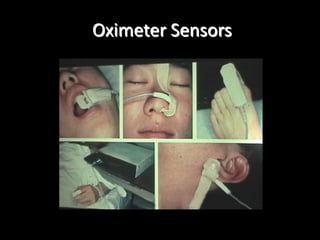 Oximeter Sensors
 