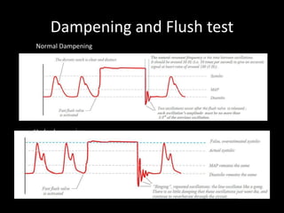 Dampening and Flush test
Underdampening
Normal Dampening
 