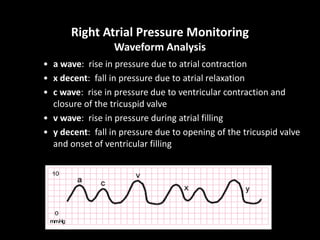 Right Atrial Pressure Monitoring
Waveform Analysis
• a wave: rise in pressure due to atrial contraction
• x decent: fall i...