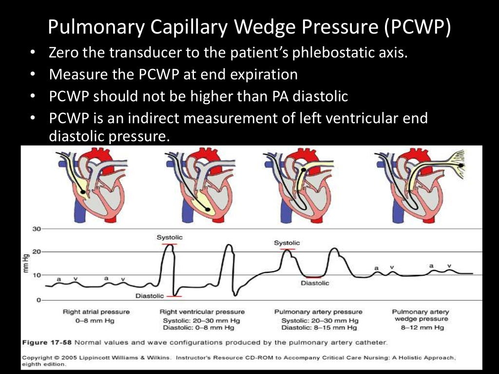 Basic hemodynamic monitoring for nurses
