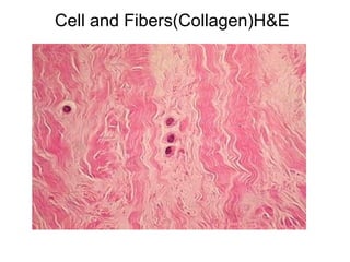 Cell and Fibers(Collagen)H&E 