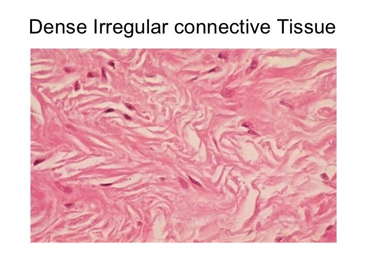 histology muscle and connective tissue Gain expert knowledge on types of tissues this histology course covers all essentials: connective tissue , muscle tissue , nerve tissue , epithelial tissue , bone tissue. histology muscle and connective tissue Gain expert knowledge on types of tissues this histology course covers all essentials: connective tissue , muscle tissue , nerve tissue , epithelial tissue , bone tissue.