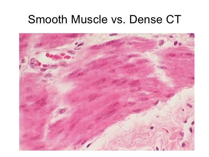 photo Dense Regular Connective Tissue Vs Smooth Muscle Histology basic histology