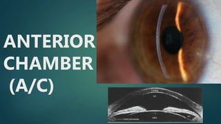 ANTERIOR
CHAMBER
(A/C)
 